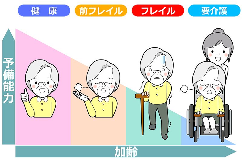 加齢に伴い予備能力が低下していく様子を「健康・前フレイル・フレイル・要介護」の4段階で表したオーラルフレイル進行図